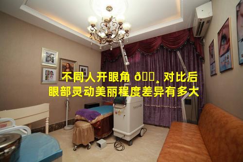 不同人开眼角 🌸 对比后眼部灵动美丽程度差异有多大